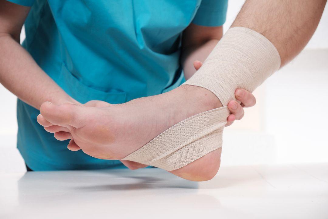 What to Expect Before & After Minimally Invasive Bunion Surgery:  Orthopaedic Foot & Ankle Center: Foot and Ankle Specialists